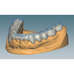 Ceramill M-Splint