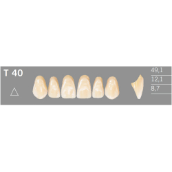 T40 Artic 6 zuby frontlne horn (VITA A1-D4)