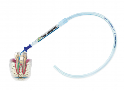 ENDO-ASPIRATOR  schma